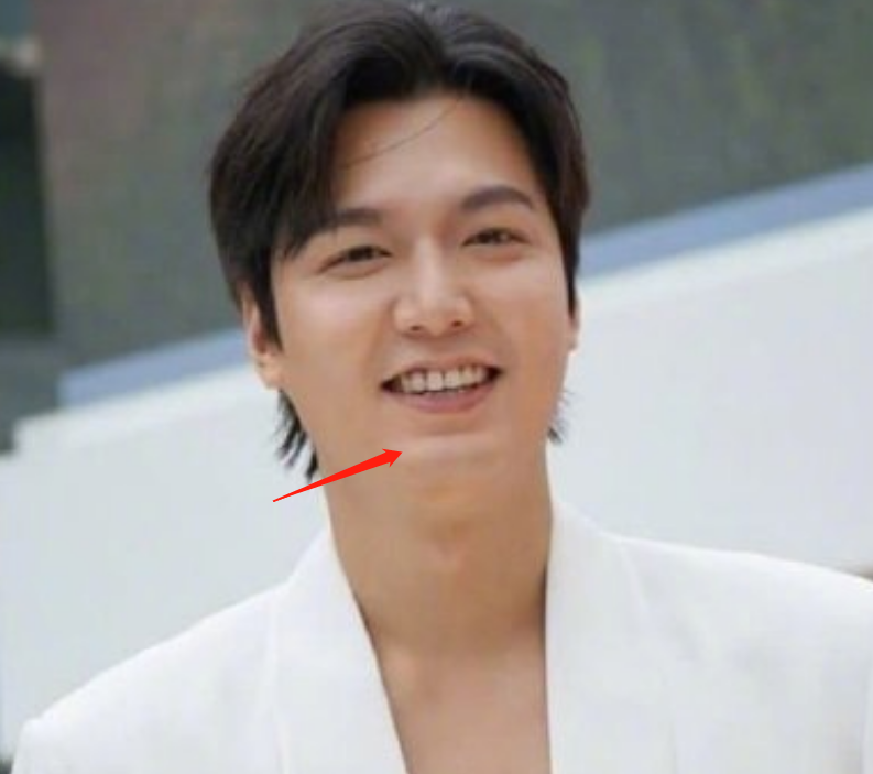 图19: 李敏镐李敏镐最新生图不敢认!脸颊胖到像气球,疑似整容后遗症爆发