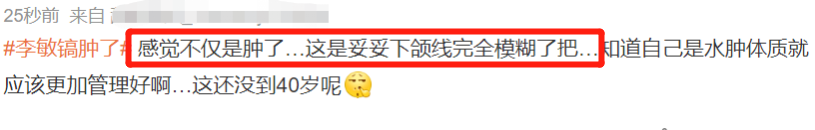 图3: 李敏镐李敏镐最新生图不敢认!脸颊胖到像气球,疑似整容后遗症爆发