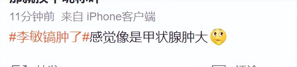 图12: 李敏镐李敏镐最新生图不敢认!脸颊胖到像气球,疑似整容后遗症爆发